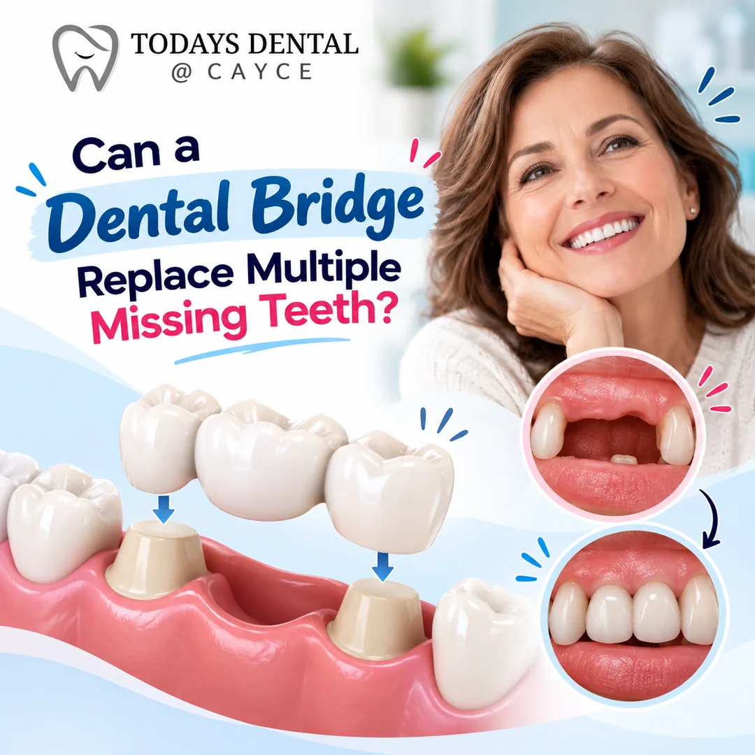 Can a Dental Bridge Replace Multiple Missing Teeth?