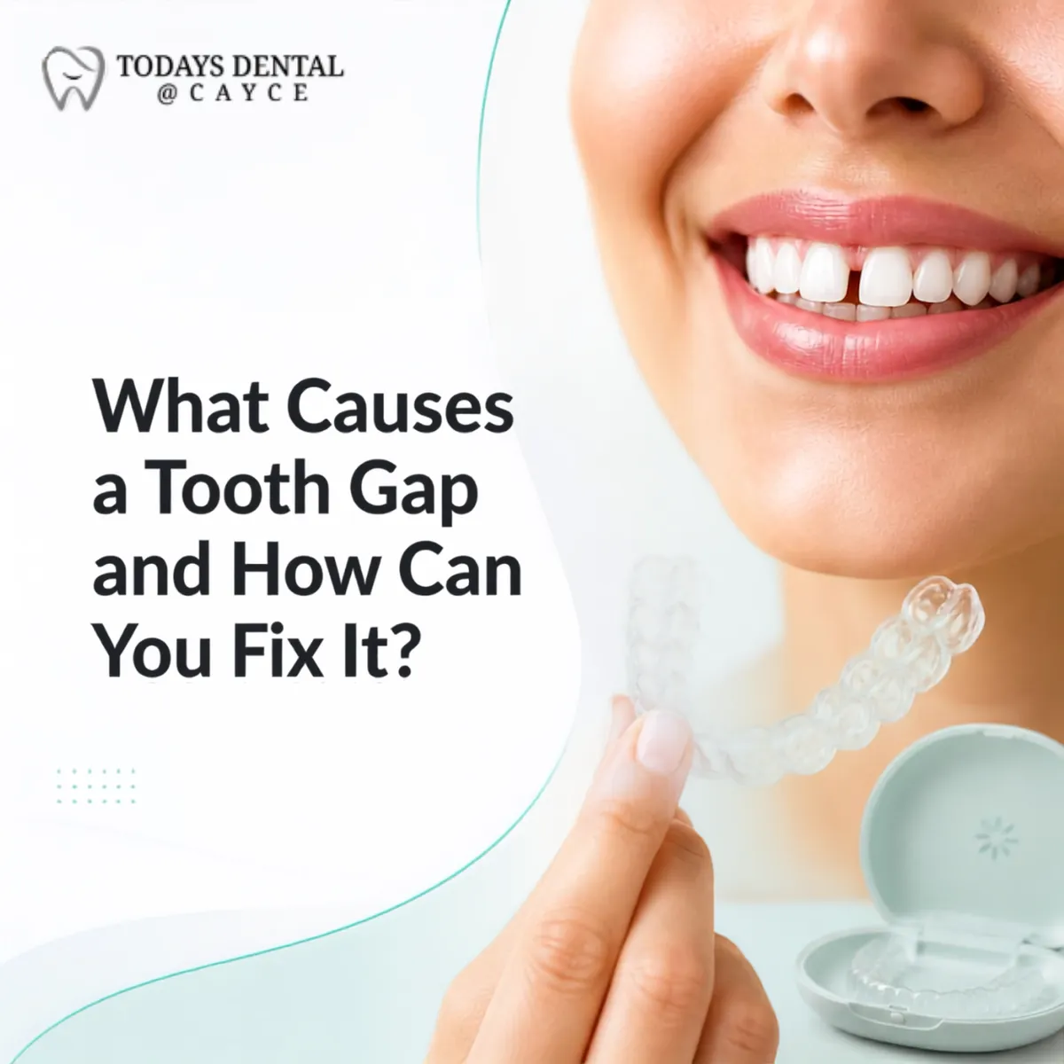 What Causes a Tooth Gap and How Can You Fix It?