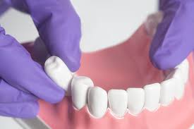 Oral Surgical Extractions