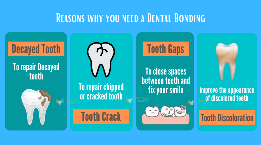  Todays Dental - Dental Bonding