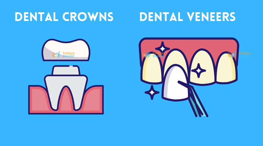 Todays Dental - Dental Crowns