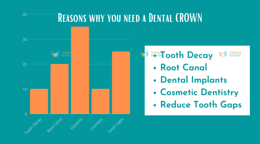 Todays Dental - Dental Crowns