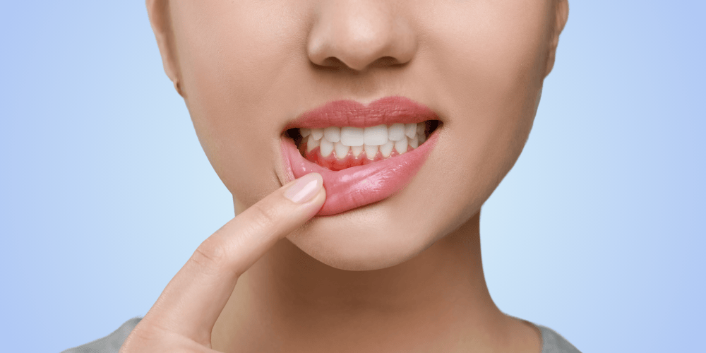 Common Causes of Tooth Infections